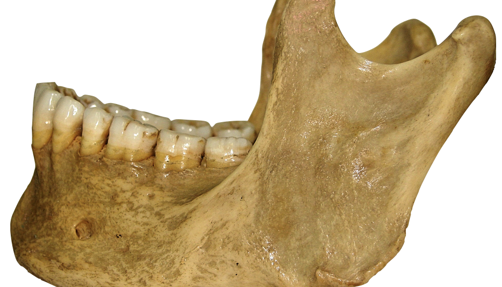 Osso ​ mandíbula (aspecto lateral).