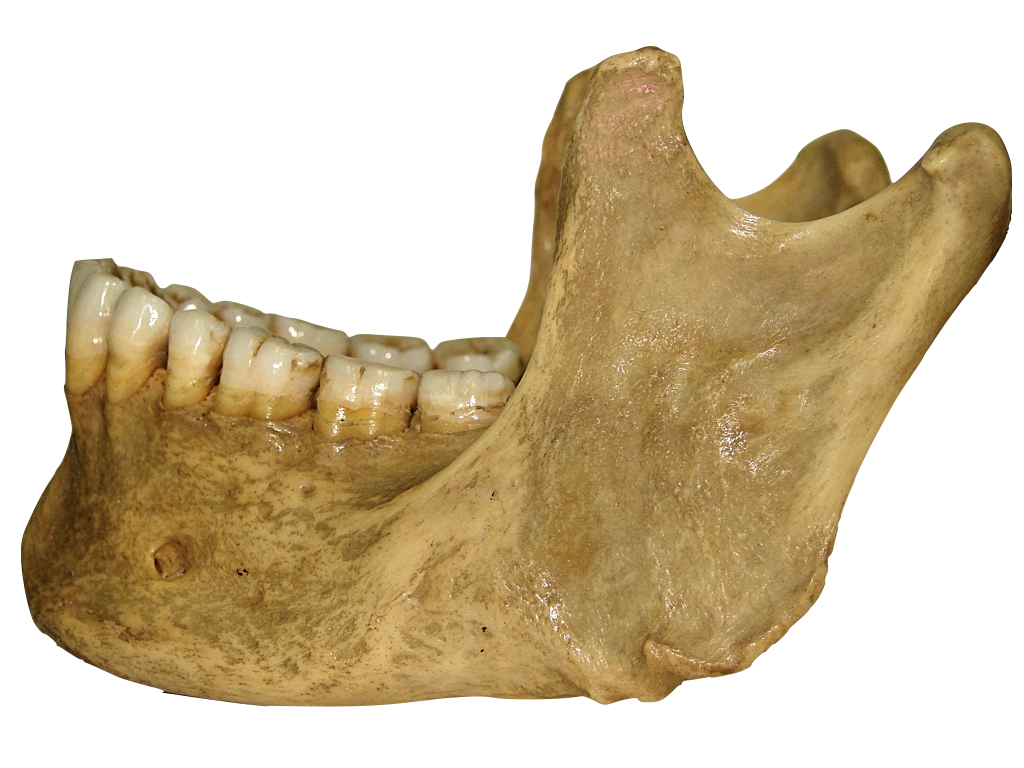 Anatomia maxila e mandibula - anatomia maxila e mandibula