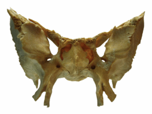 OSSO - ESFENOIDE.017